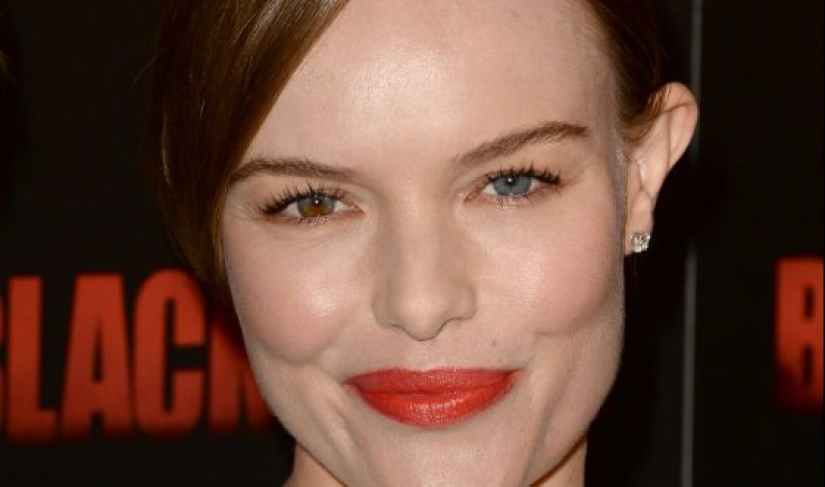 El color de ojos más raros en el mundo El color de ojos más raros en el mundo