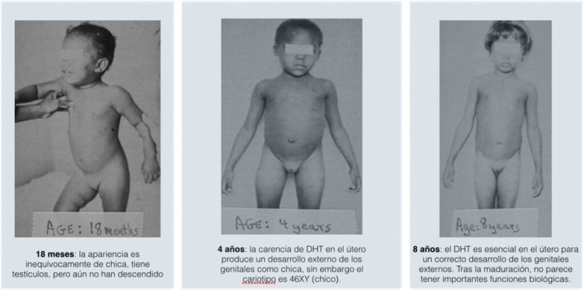 El fenómeno Guevedos: ¿Por qué las niñas en República Dominicana se convierten en niños?