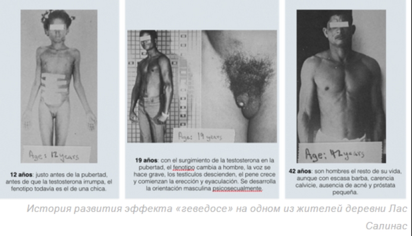 El fenómeno Guevedos: ¿Por qué las niñas en República Dominicana se convierten en niños?