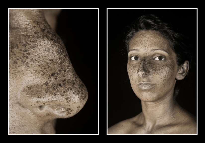 El fotógrafo mostró cuánto cambia la piel el sol. ¡Después de eso, dejarás de amar el bronceado!