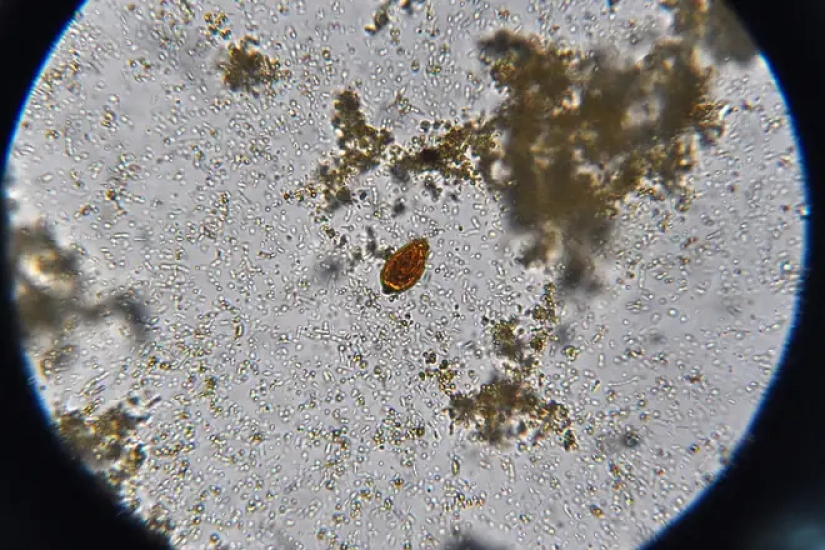 El mortal plato tailandés Koi Pla, que mata a miles de personas cada año El mortal plato tailandés Koi Pla, que mata a miles de personas cada año