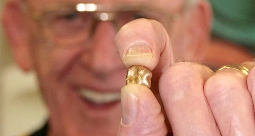 El oro de los muertos: Qué sucede con las coronas de oro durante la cremación El oro de los muertos: Qué sucede con las coronas de oro durante la cremación