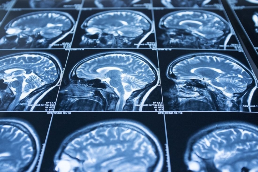 El "pensamiento Lateral": las trampas del cerebro que nos impiden pensar, y las formas de evitarlos