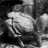 Es difícil de creer, pero estas 5 personas con anomalías realmente existió!