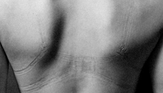 Eso es lo que hay detrás del esplendor femenino. Es doloroso ver estas fotos