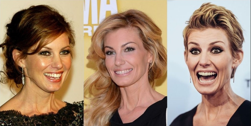 Estas celebridades le mostrarán cómo los frenillos pueden cambiar drásticamente su sonrisa.