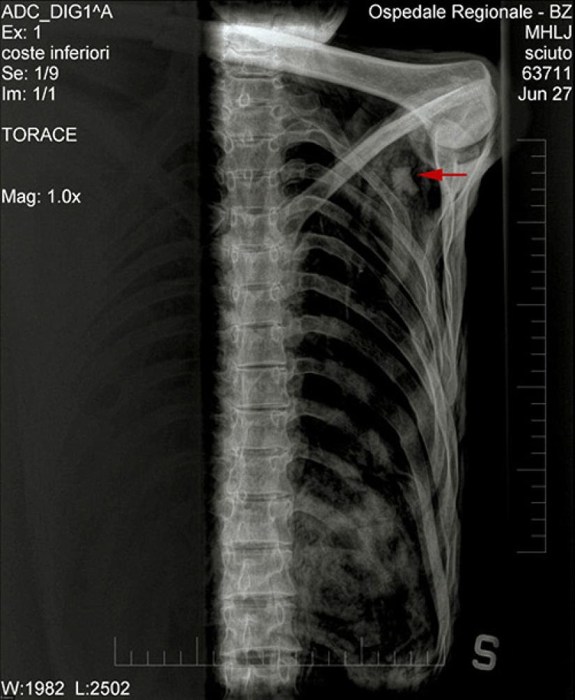 Etzi's "Ice Man" and his story Etzi's "Ice Man" and his story