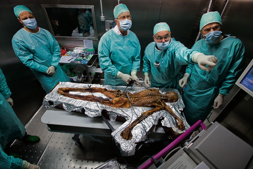 Etzi's "Ice Man" and his story Etzi's "Ice Man" and his story