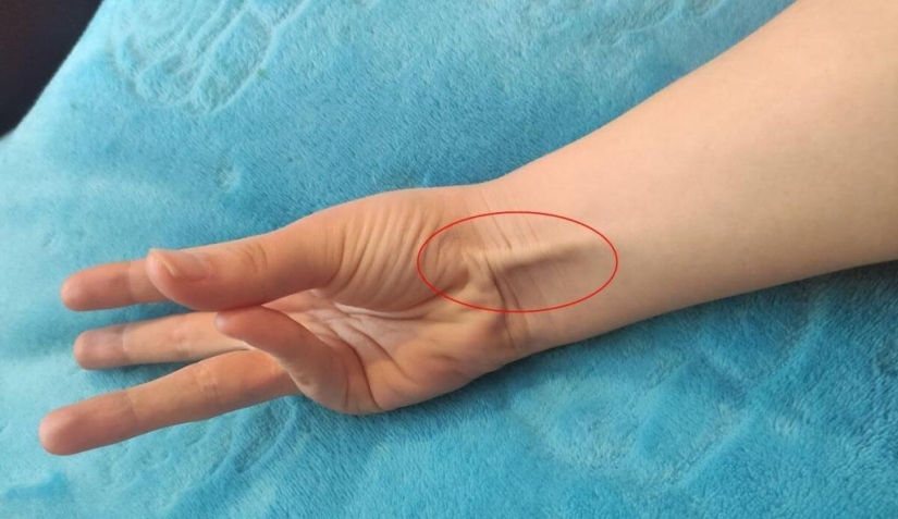 Evolutionary Atavisms: 7 Organs We No Longer Need Evolutionary Atavisms: 7 Organs We No Longer Need