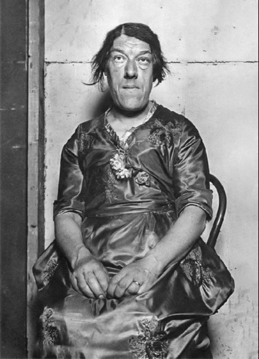 From beauty in the beast: a history of Mary Ann Webster — the most ugly women in the world