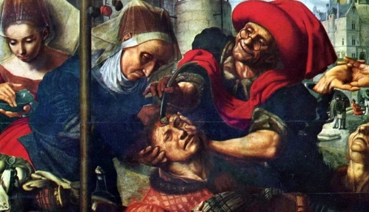 From Hippocrates to Pirogov: military field surgery in different eras