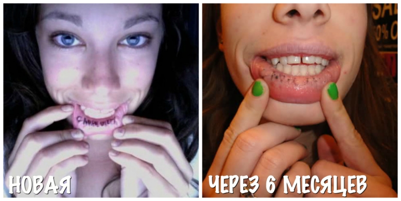 Fue-se convirtió: cómo envejecen los tatuajes Fue-se convirtió: cómo envejecen los tatuajes