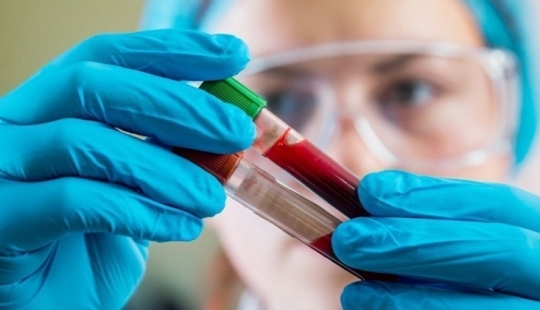 "Golden blood" with a zero Rh factor — why it is both salutary and dangerous at once "Golden blood" with a zero Rh factor — why it is both salutary and dangerous at once