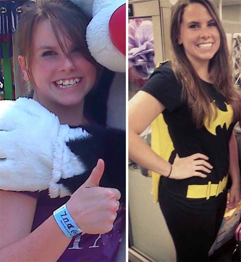 Here's how radically braces change a smile and life Here's how radically braces change a smile and life