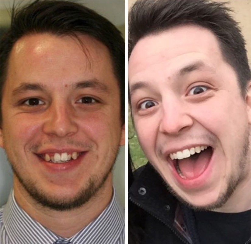 Here's how radically braces change a smile and life Here's how radically braces change a smile and life