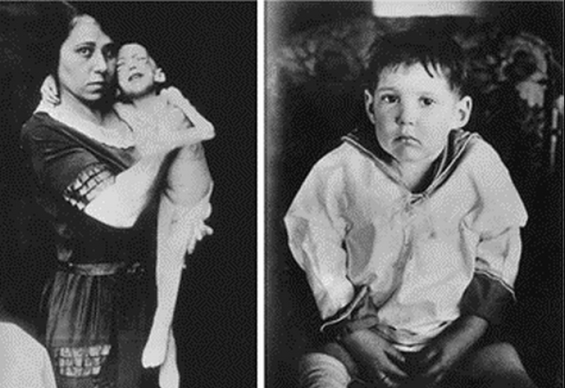 How the lives of diabetics have changed over the past 100 years