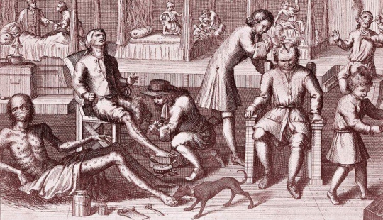 How venereal diseases were treated in the old days: lead weights, a whip and mercury ointments How venereal diseases were treated in the old days: lead weights, a whip and mercury ointments