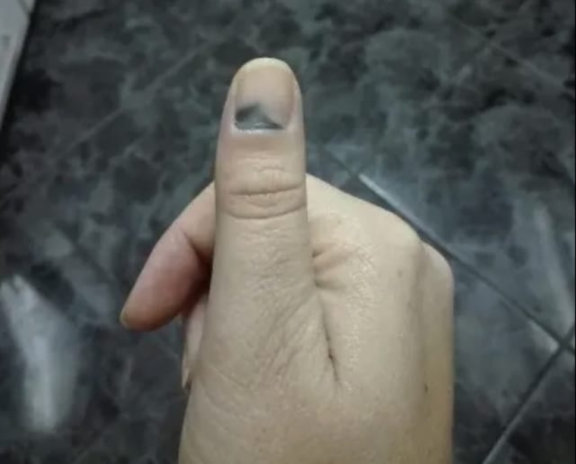 Huge legs, huge belly, huge everything: 22 photos about the reality of pregnant women