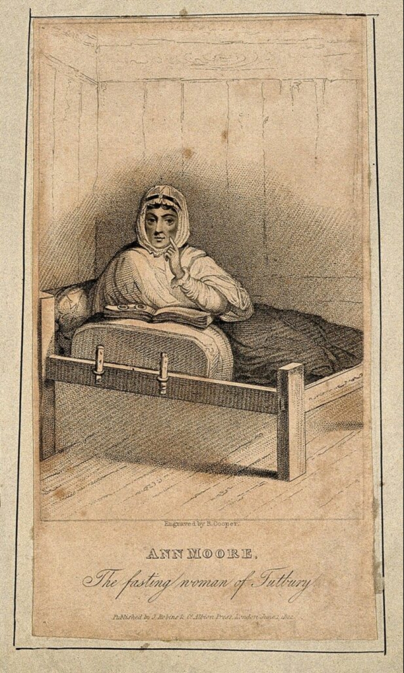"Hungry Ann": The Story of a Woman Who Lived Without Food for 5 Years "Hungry Ann": The Story of a Woman Who Lived Without Food for 5 Years