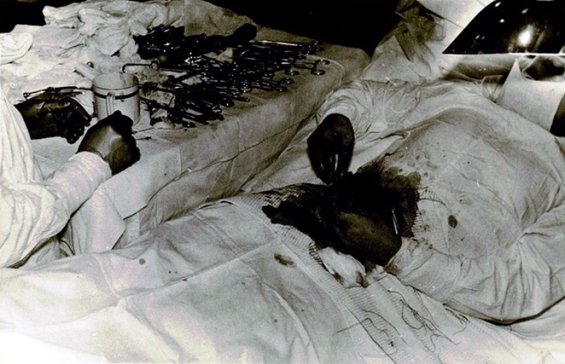 Increíble fortaleza y coraje: cómo un médico ruso se operó a sí mismo