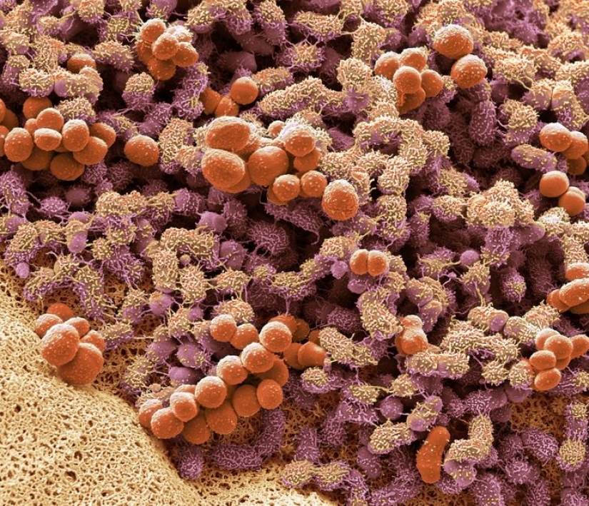 Increíble mundo bajo el microscopio: 22 fotos que te harán ver todo de una manera nueva Increíble mundo bajo el microscopio: 22 fotos que te harán ver todo de una manera nueva