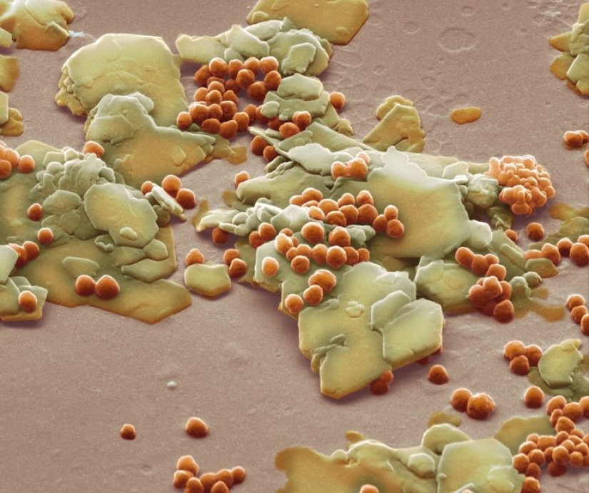 Increíble mundo bajo el microscopio: 22 fotos que te harán ver todo de una manera nueva Increíble mundo bajo el microscopio: 22 fotos que te harán ver todo de una manera nueva