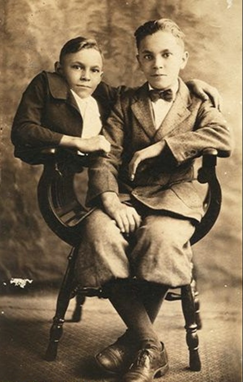 Johnny Eck, el "rey de los freaks" que nació con medio cuerpo