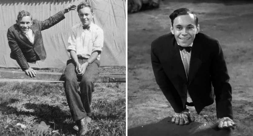 Johnny Eck, the "king of the freaks" who was born with half a body Johnny Eck, the "king of the freaks" who was born with half a body