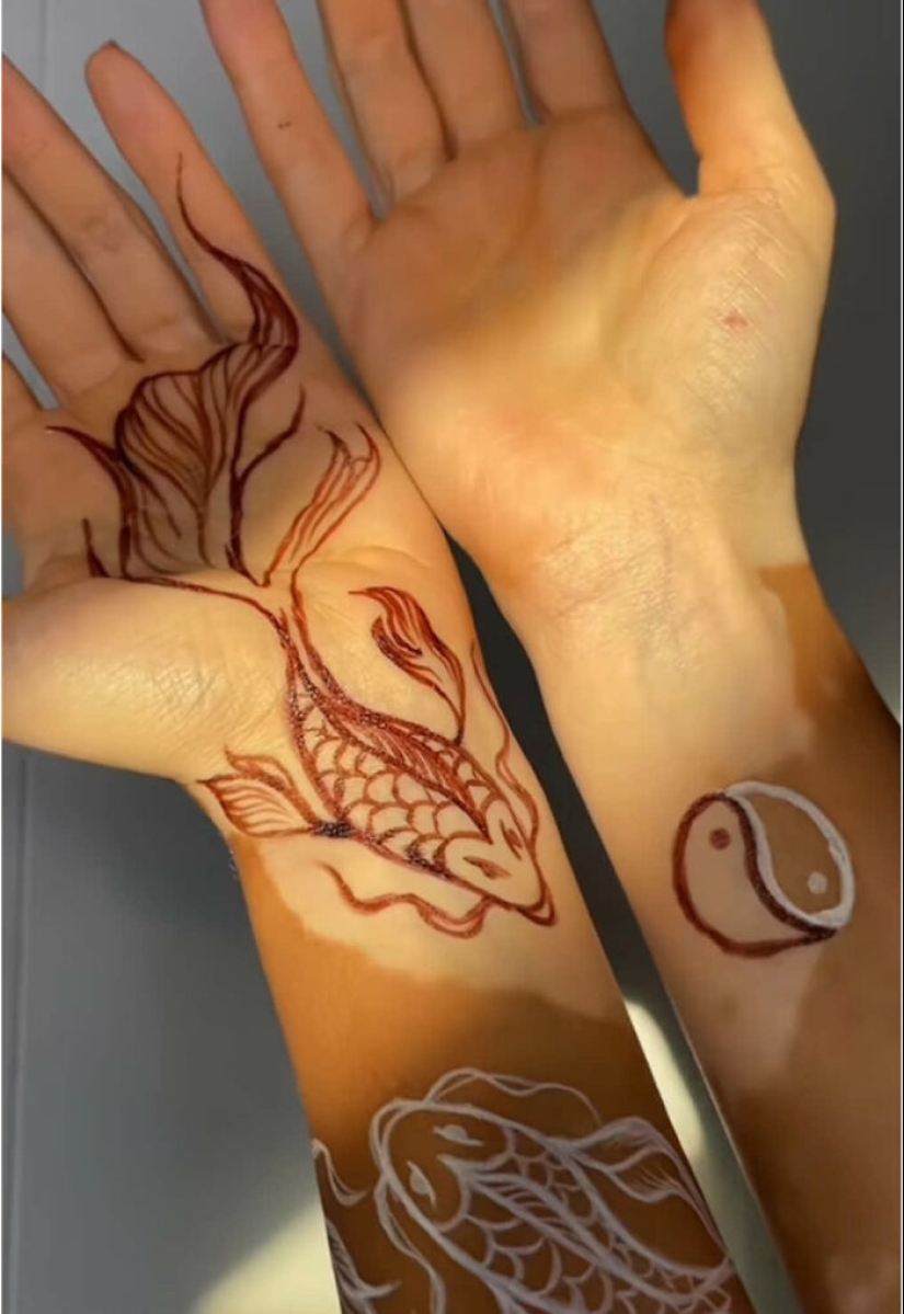 La bailarina convertida en artista Amara Alemán convierte su vitíligo en vibrante arte corporal