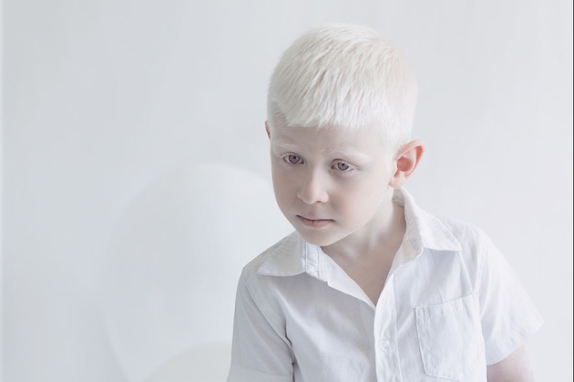 La belleza hipnótica de los albinos en el proyecto fotográfico de Yulia Taits La belleza hipnótica de los albinos en el proyecto fotográfico de Yulia Taits