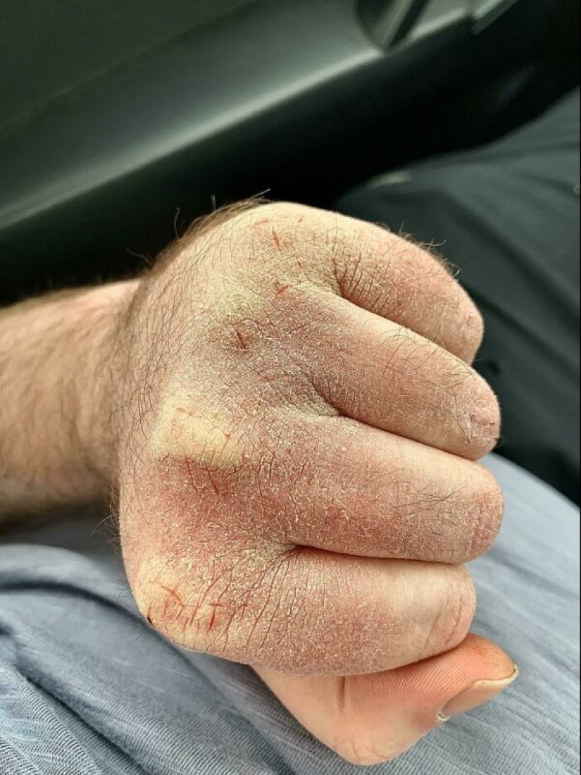 La gente mostró su mal día. Y lo lamentan de verdad