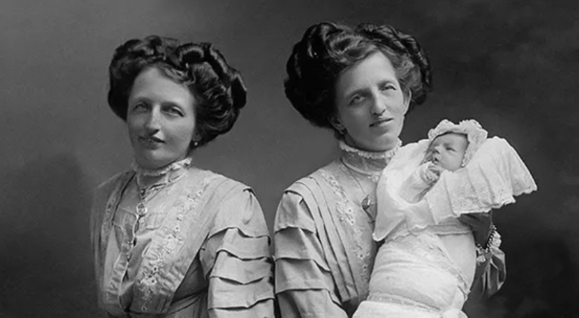 La historia de dos siamesas, las hermanas Blazek, una de las cuales dio a luz a un niño. La historia de dos siamesas, las hermanas Blazek, una de las cuales dio a luz a un niño.