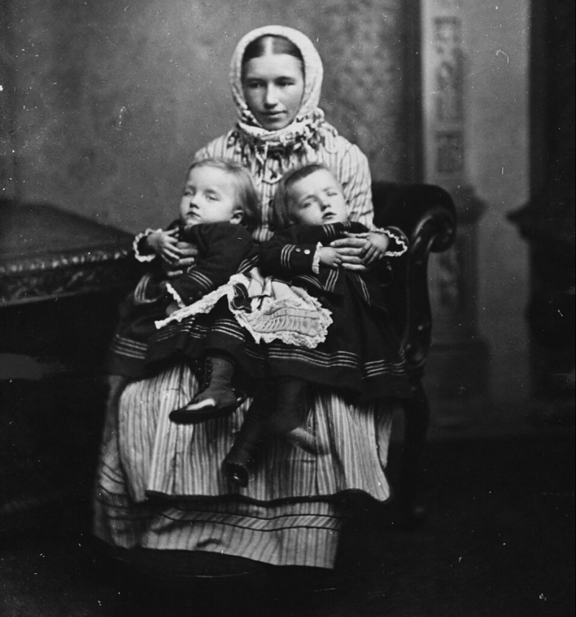 La historia de dos siamesas, las hermanas Blazek, una de las cuales dio a luz a un niño. La historia de dos siamesas, las hermanas Blazek, una de las cuales dio a luz a un niño.