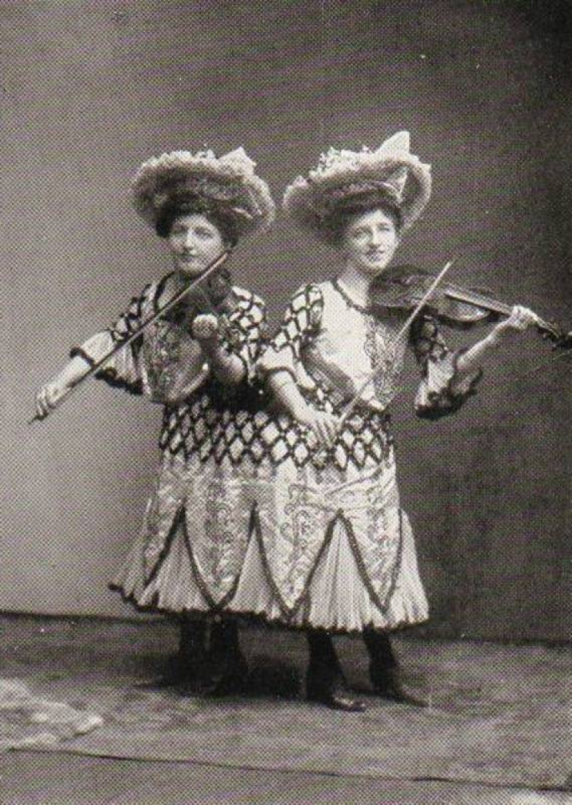 La historia de dos siamesas, las hermanas Blazek, una de las cuales dio a luz a un niño. La historia de dos siamesas, las hermanas Blazek, una de las cuales dio a luz a un niño.