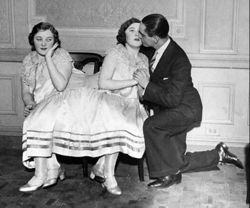 La historia de dos siamesas, las hermanas Blazek, una de las cuales dio a luz a un niño. La historia de dos siamesas, las hermanas Blazek, una de las cuales dio a luz a un niño.