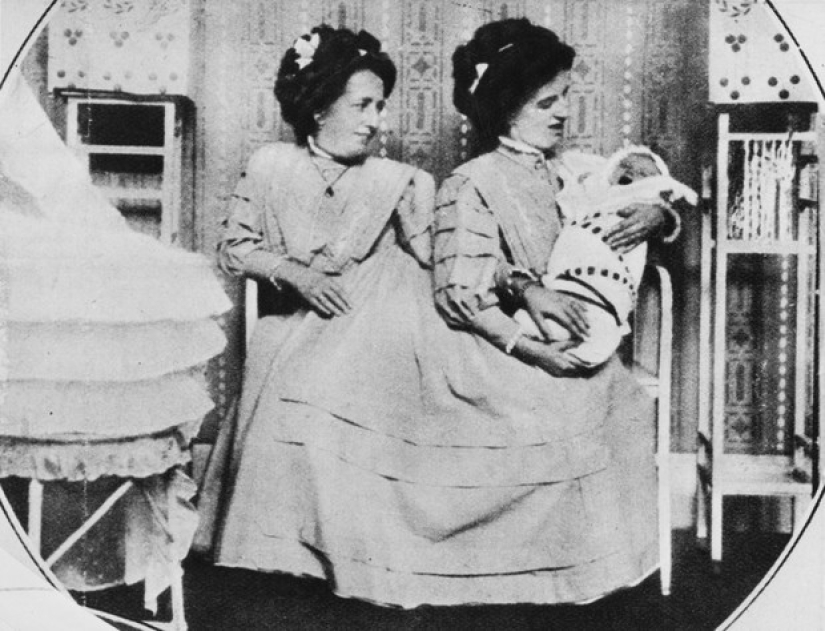 La historia de dos siamesas, las hermanas Blazek, una de las cuales dio a luz a un niño. La historia de dos siamesas, las hermanas Blazek, una de las cuales dio a luz a un niño.