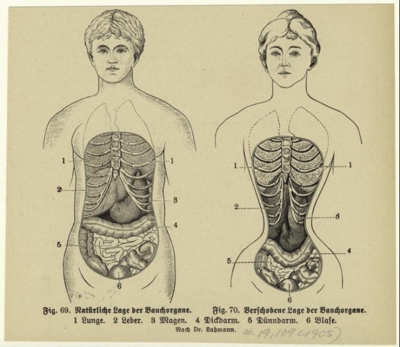 La historia de la ropa interior femenina: lo que se escondía debajo de las túnicas y faldas de las fashionistas de diferentes épocas La historia de la ropa interior femenina: lo que se escondía debajo de las túnicas y faldas de las fashionistas de diferentes épocas