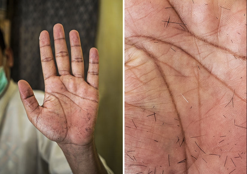 Lo que las manos de una persona pueden decirte. Proyecto fotográfico de Omar Reda