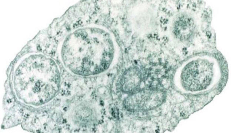 Los 25 parásitos más inusuales y peligrosos