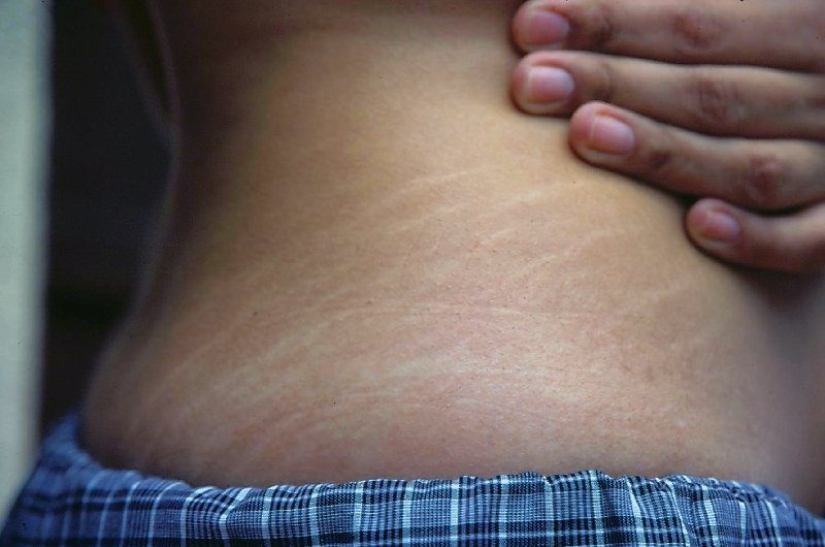 Mala manicura, celulitis y otras mujeres "defectos" que los hombres no se preocupan Mala manicura, celulitis y otras mujeres "defectos" que los hombres no se preocupan