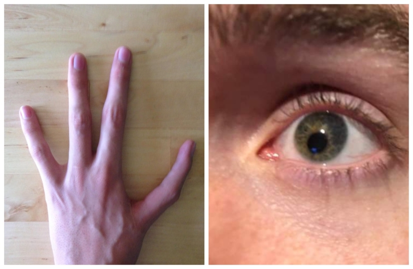 No como todos los demás: 22 fotos de personas a las que la naturaleza ha hecho diferente de los demás No como todos los demás: 22 fotos de personas a las que la naturaleza ha hecho diferente de los demás