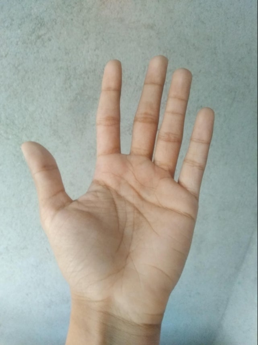 No como todos los demás: 22 fotos de personas a las que la naturaleza ha hecho diferente de los demás No como todos los demás: 22 fotos de personas a las que la naturaleza ha hecho diferente de los demás