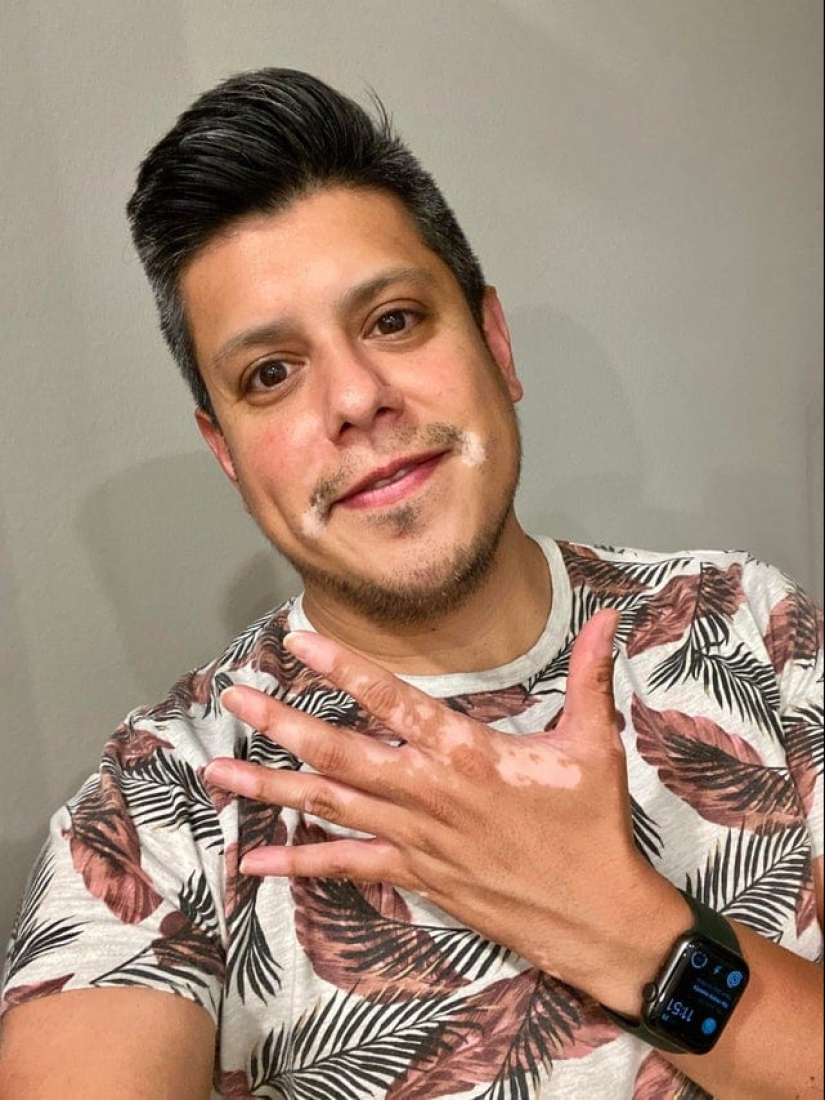 No como todos los demás: 22 fotos de personas a las que la naturaleza ha hecho diferente de los demás No como todos los demás: 22 fotos de personas a las que la naturaleza ha hecho diferente de los demás