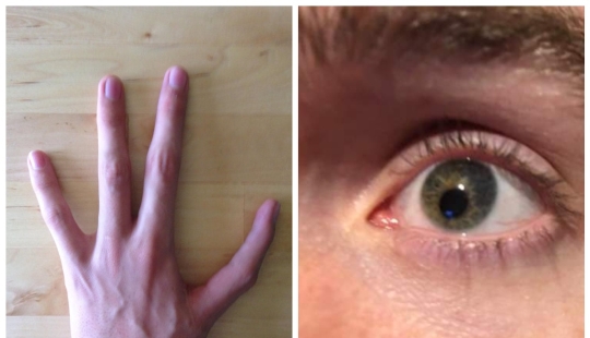 No como todos los demás: 22 fotos de personas a las que la naturaleza ha hecho diferente de los demás