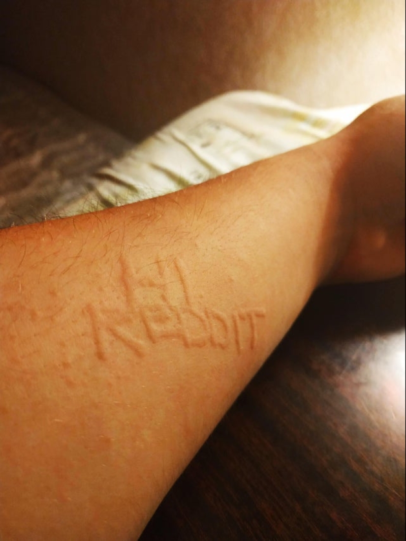 No como todos los demás: 22 fotos de personas a las que la naturaleza ha hecho diferente de los demás No como todos los demás: 22 fotos de personas a las que la naturaleza ha hecho diferente de los demás