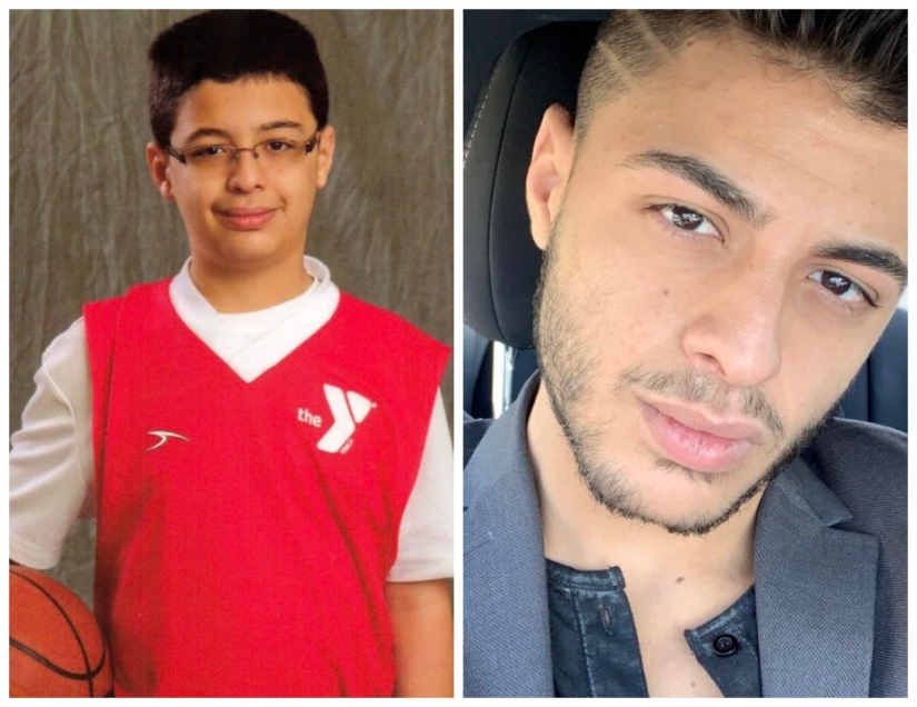 No more "ugly ducklings": 22 photos "before and after" that will amaze you No more "ugly ducklings": 22 photos "before and after" that will amaze you