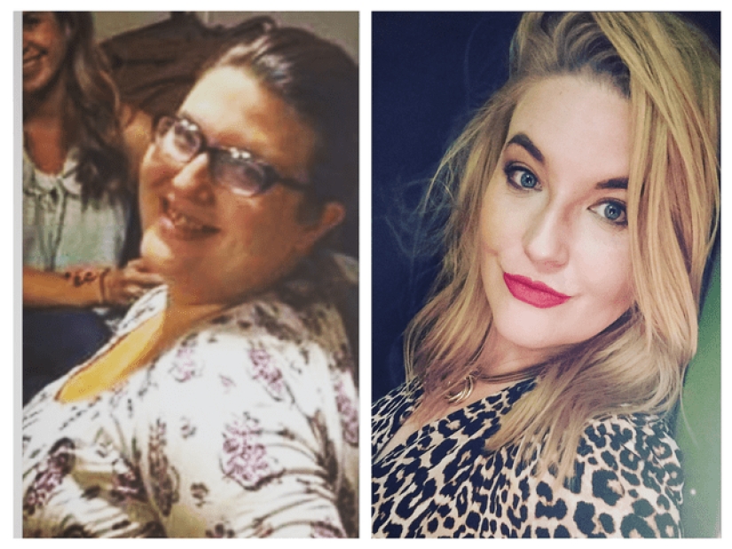 No more "ugly ducklings": 22 photos "before and after" that will amaze you No more "ugly ducklings": 22 photos "before and after" that will amaze you