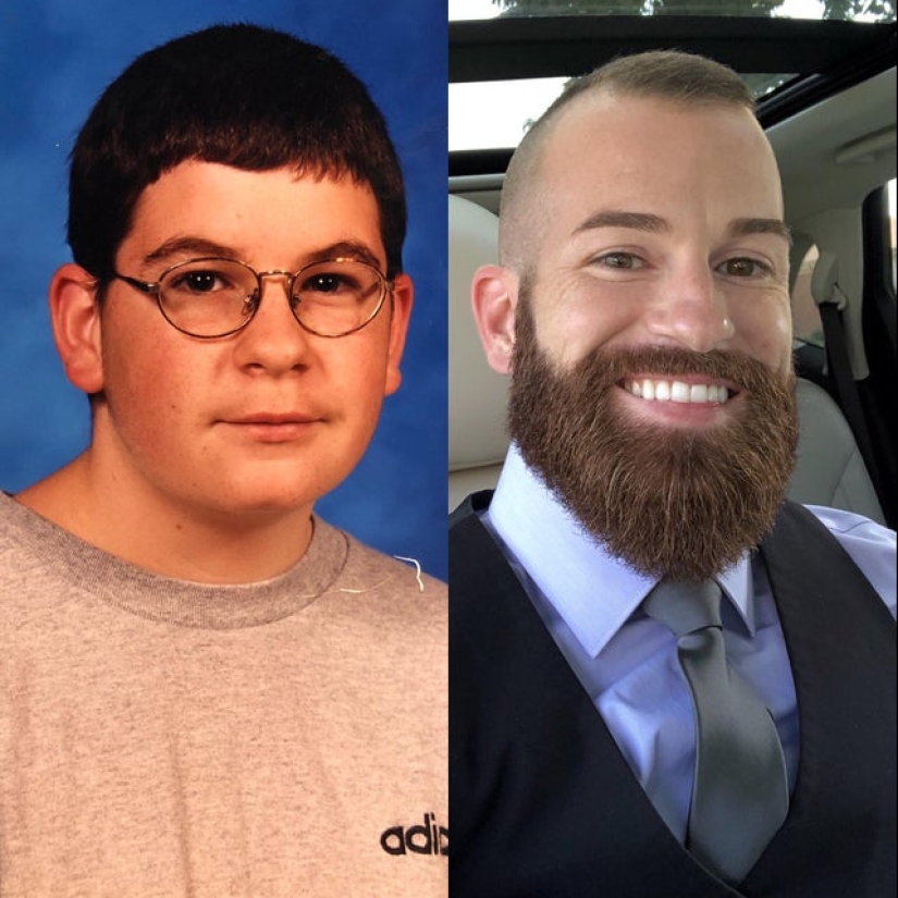 No more "ugly ducklings": 22 photos "before and after" that will amaze you No more "ugly ducklings": 22 photos "before and after" that will amaze you