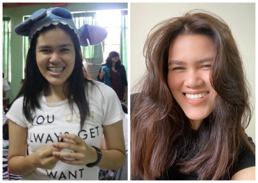 No more "ugly ducklings": 22 photos "before and after" that will amaze you No more "ugly ducklings": 22 photos "before and after" that will amaze you