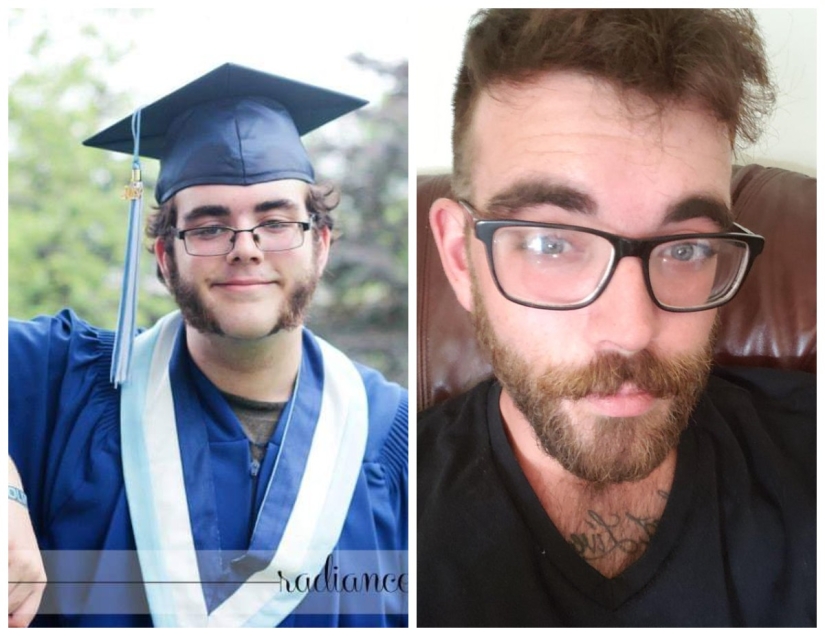 No más "patitos feos" : 22 fotos "antes y después" que te sorprenderán No más "patitos feos" : 22 fotos "antes y después" que te sorprenderán